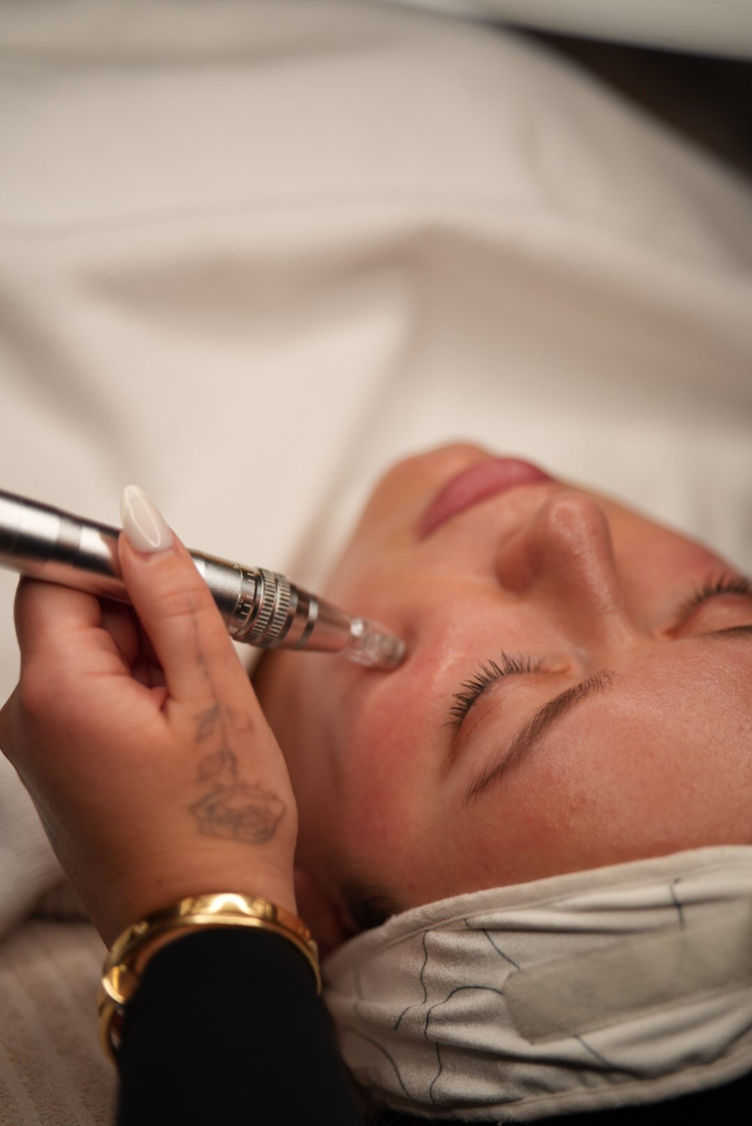 Microneedling Erfurt